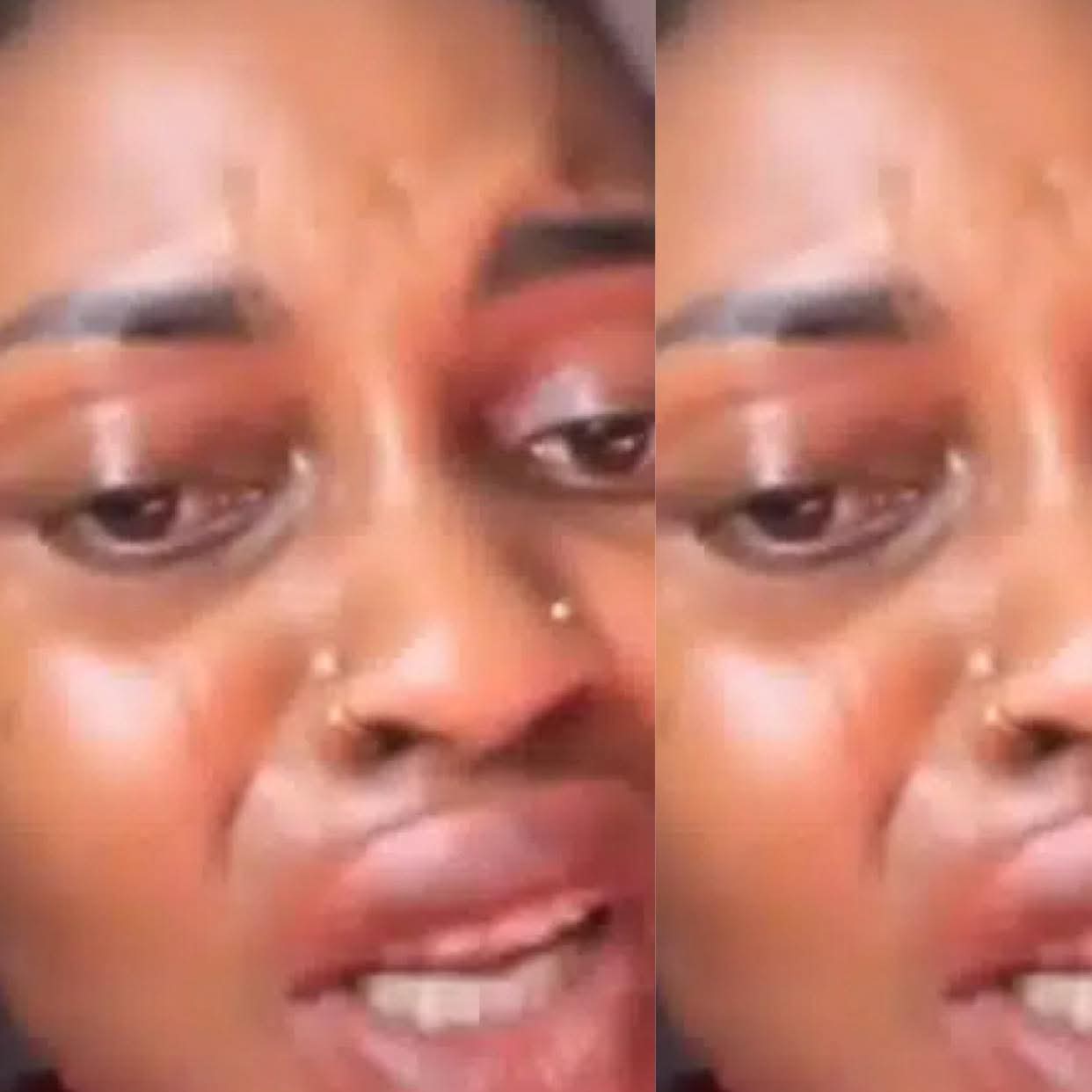 Woman’s Lips Sw£ll Badly After Using Online Kayamata Product Woman’s Lips Sw£ll Badly After Using Online Kayamata Product