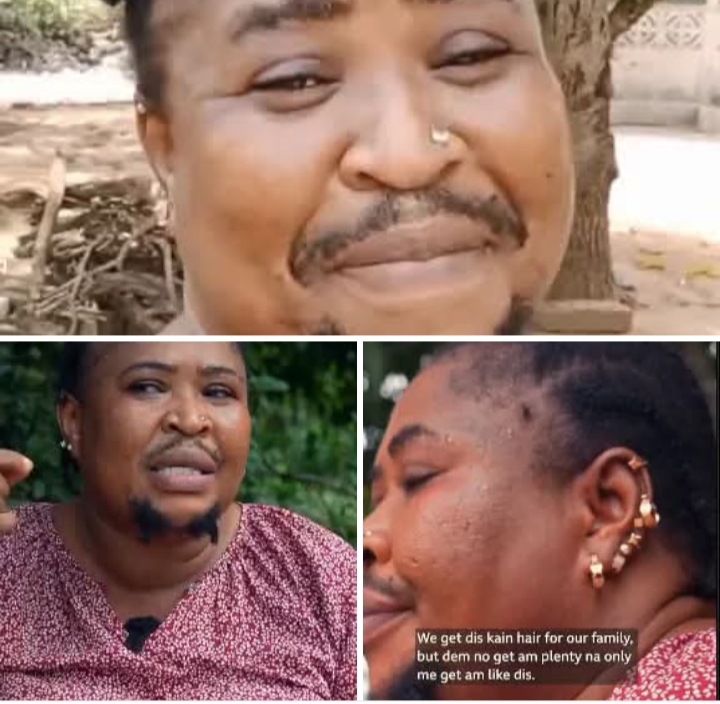 I want to look different, woman living with facial hair shares story